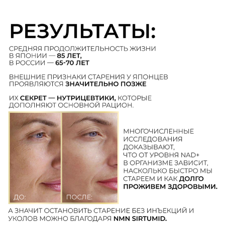 2/NMN Sirtumid, 60 капсул Dr. Zubareva